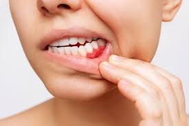 Periodoncia en Cánovas