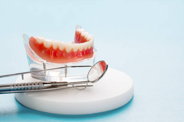 Prótesis dentales en Cánovas
